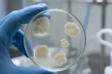 Why Antibiotic Resistance Keeps Getting Worse